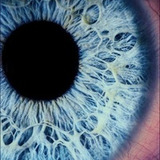 A-a
