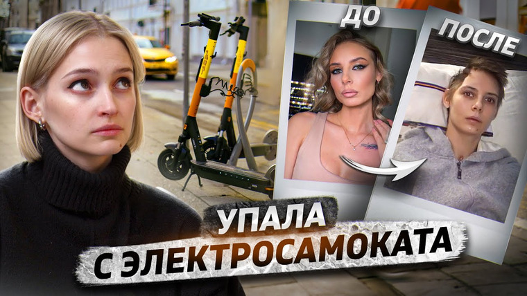 КОСАТКИНА — s06e14 — Упала с электросамоката и стала инвалидом