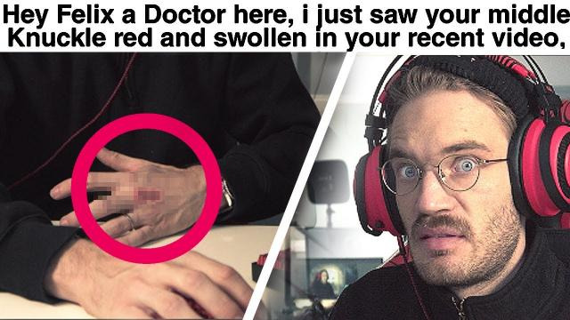 PewDiePie — s11e239 — Doctor Reacts To my Injury (serious) — LWIAY #00142