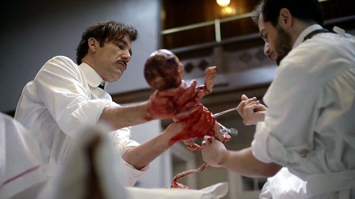 The Knick — s01e06 — Start Calling Me Dad