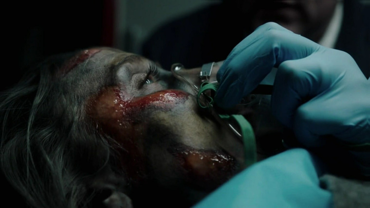 People Magazine Investigates — s03e14 — Burned Alive