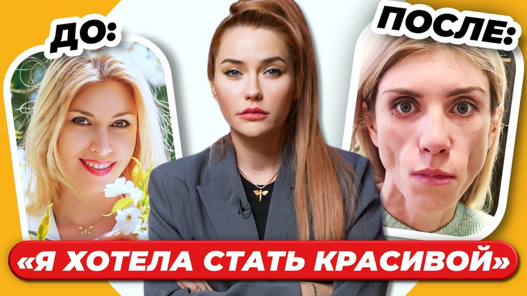 Катя Конасова — s08e63 — ЖИЗНЬ БЕЗ ЛИЦА: До и После пластики ❌ | ошибки пластических хирургов