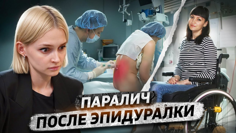 КОСАТКИНА — s06e16 — «Зато у тебя больше не болят ноги» | Парализовало после эпидуральной анестезии
