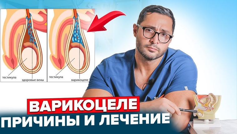 Александр Дзидзария — s01e12 — Как обнаружить Варикоцеле и кому нужна операция