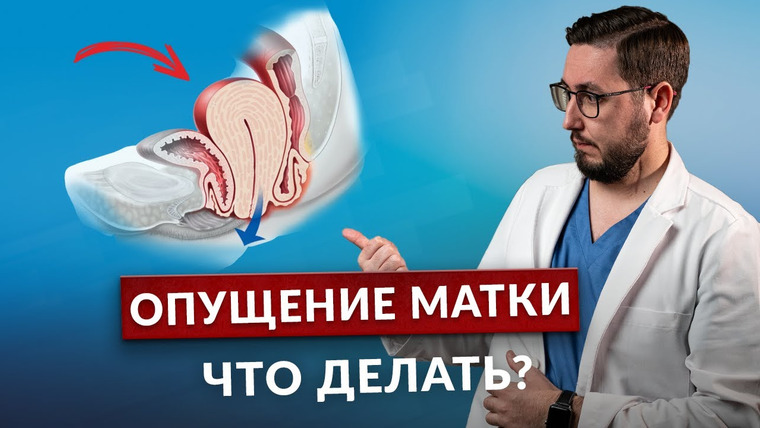 Доктор Николаев — s05e04 — Что на самом деле означает "опущение матки и стенок влагалища"? Объяснение гинеколога