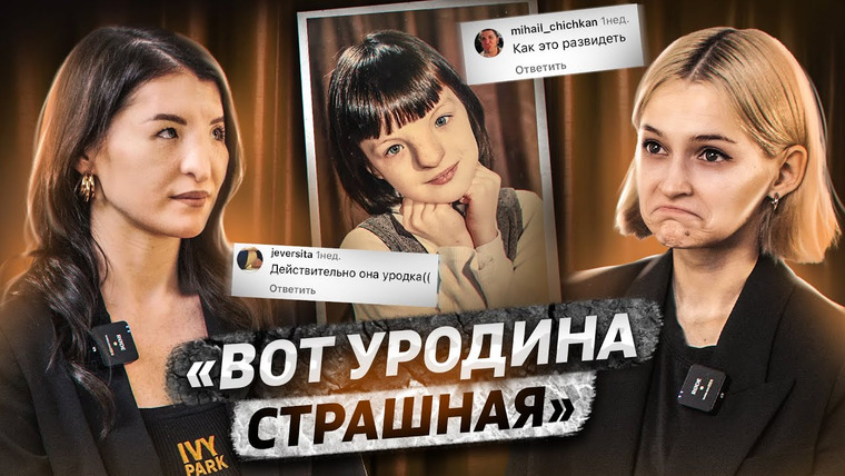КОСАТКИНА — s05e36 — Девочка с носом Аватара | Гипертелоризм II степени