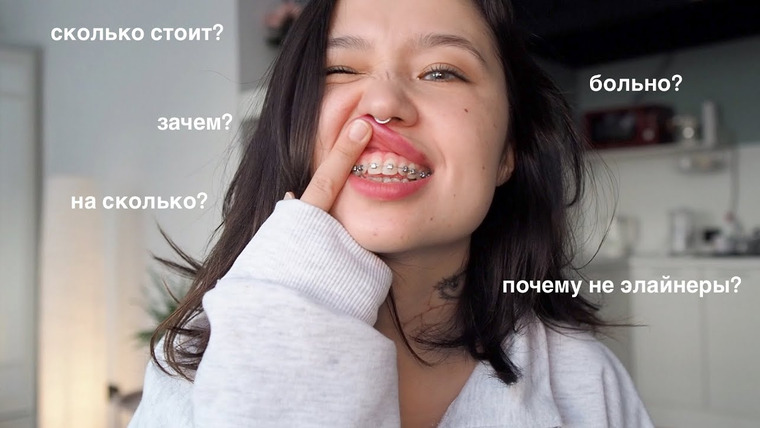 Казанцева Саша — s2023e18 — мне поставили брекеты!