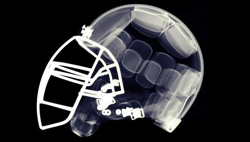 На передовой — s2013e17 — League of Denial: The NFL's Concussion Crisis