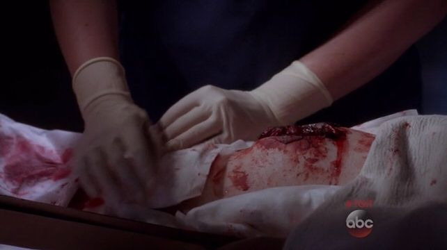 Grey's Anatomy — s11e22 — She's Leaving Home: Part 1