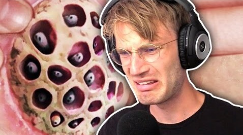 PewDiePie — s07e279 — (WARNING GROSS) CURING MY TRYPOPHOBIA