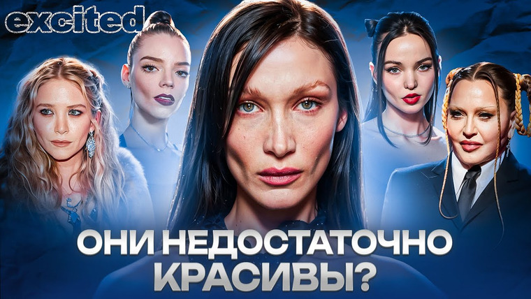 Dana Excited — s02e31 — ОДЕРЖИМОСТЬ пластикой: под НОЖ ради успеха?