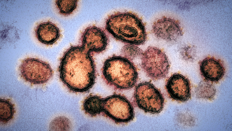 Чтобы вы поняли... коронавирус — s01e01 — This Pandemic