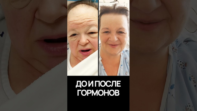 Александр Панчин — s10e155 — Правда о гормонах: почему нас зря пугают