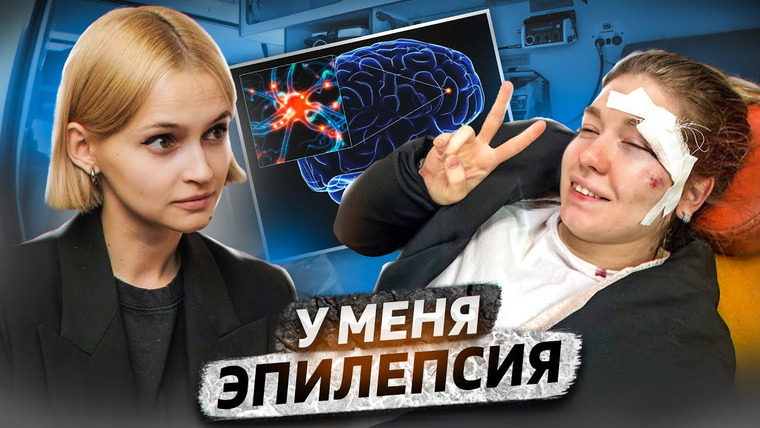 КОСАТКИНА — s05e41 — «Упала лицом на асфальт, ничего не помню» | Эпилепсия: приступы, лечение