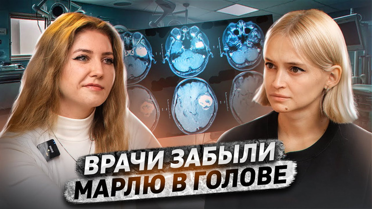 КОСАТКИНА — s05e32 — Потеряла слух в 21 | Нейрофиброматоз II типа