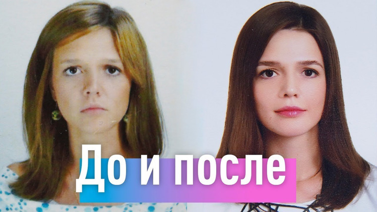 Евгения Стрелецкая — s2019e91 — Как психотерапия изменила моё лицо