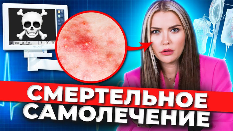 Катя Конасова — s08e37 — ОПАСНЫЕ ПРЫЩИ ⚠️ Смертельные капельницы красоты