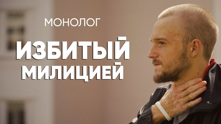 Онлайнер — s01e70 — #монолог пострадавшего от белорусской милиции: до сих пор на костылях