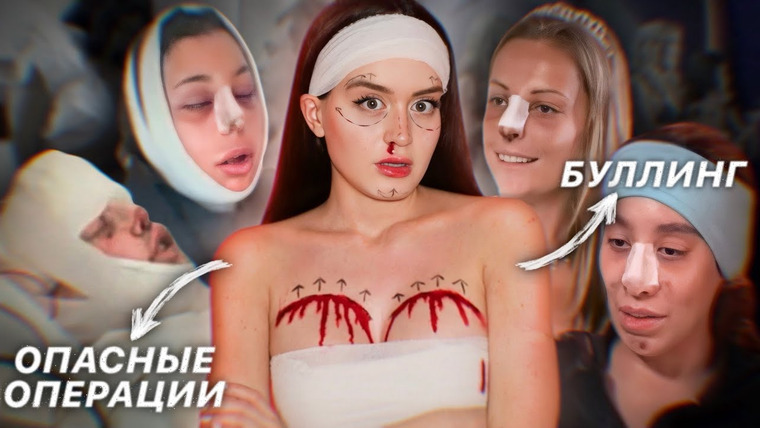 Alina Мuradimova — s05e43 — Из гадкого утенка — В ПЛАСТИКОВУЮ КУКЛУ | Самое ОПАСНОЕ шоу нулевых: «The Swan»