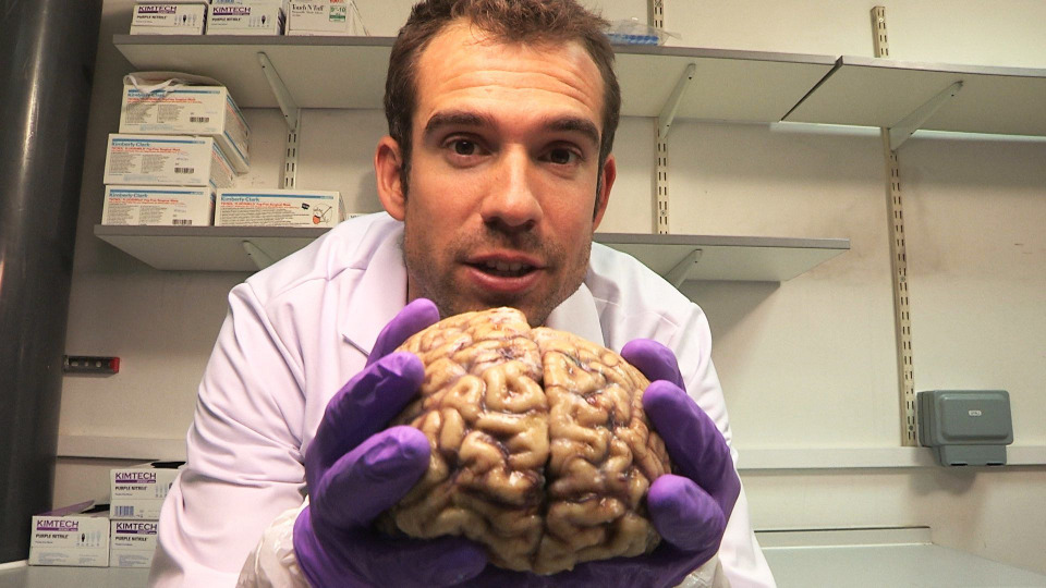 s01e02 — Your Brilliant Brain