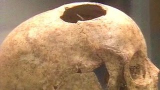 s01e02 — Galen, Doctor to the Gladiators