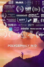 Polycephaly in D