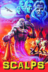 Скальпы