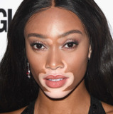 Winnie Harlow โ Self