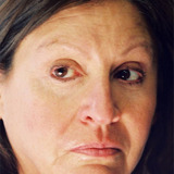 Сьюзэн Мерсон — Woman with Cancer