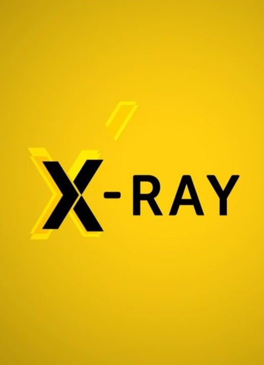 Сериал X-Ray
