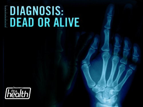 Show Diagnosis: Dead or Alive