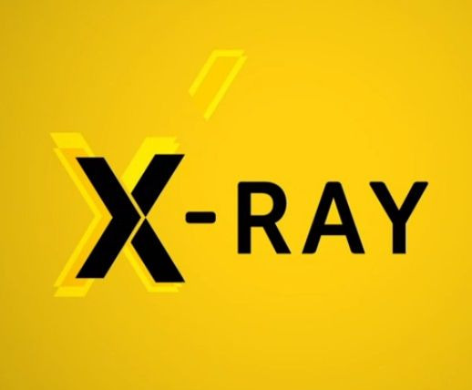 Сериал X-Ray