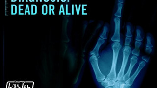 Diagnosis: Dead or Alive season 1